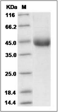 Human TNFR2 / CD120b / TNFRSF1B Protein (aa 1-268, 196 Met/Arg, His Tag) SDS-PAGE