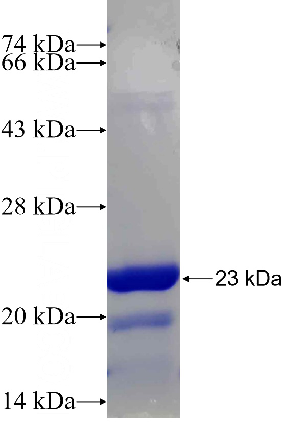 Recombinant Human DUB3 SDS-PAGE