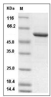 Rat Galectin-8 / LGALS8 Protein (GST Tag) SDS-PAGE