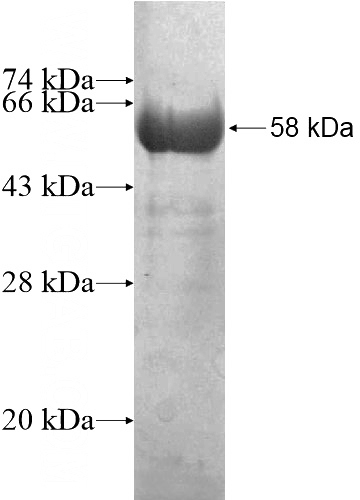 Recombinant Human MYT1 SDS-PAGE