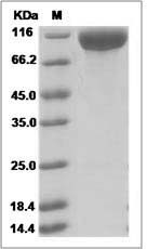 Rat ICAM-1 / CD54 Protein (Fc Tag) SDS-PAGE
