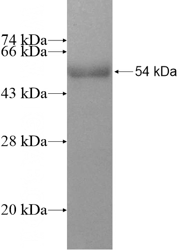 Recombinant Human RABL2A SDS-PAGE