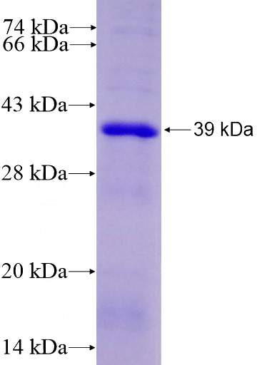 Recombinant Human RAPGEF4 SDS-PAGE
