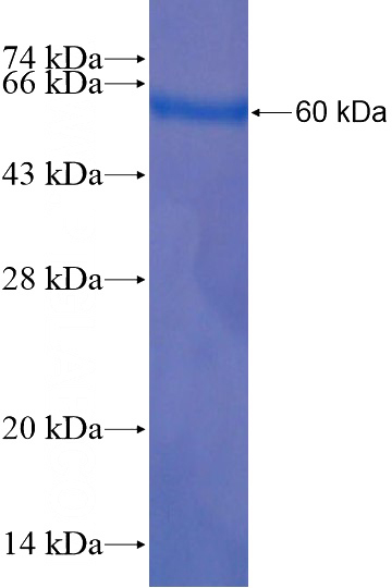 Recombinant Human CHD5 SDS-PAGE