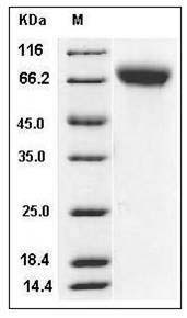 Rat ICAM-1 / CD54 Protein (His Tag) SDS-PAGE