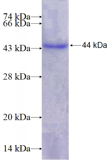 Recombinant Human RYK SDS-PAGE