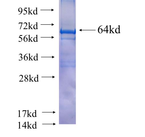 Recombinant human SPAG6 SDS-PAGE