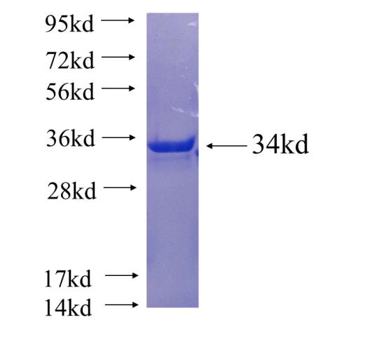Recombinant human ENAH SDS-PAGE