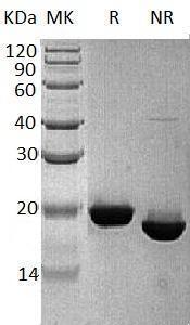 Human RBP4/PRO2222 recombinant protein