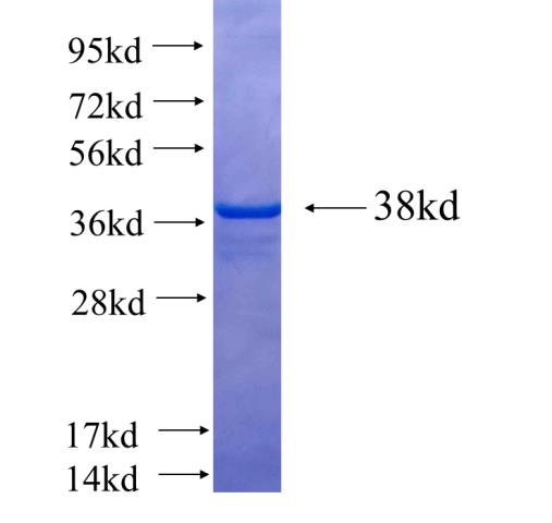 Recombinant human MARK1 SDS-PAGE