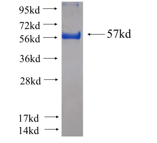 Recombinant human CALCOCO2 SDS-PAGE