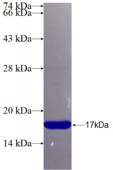 Recombinant Human MKP-2 SDS-PAGE