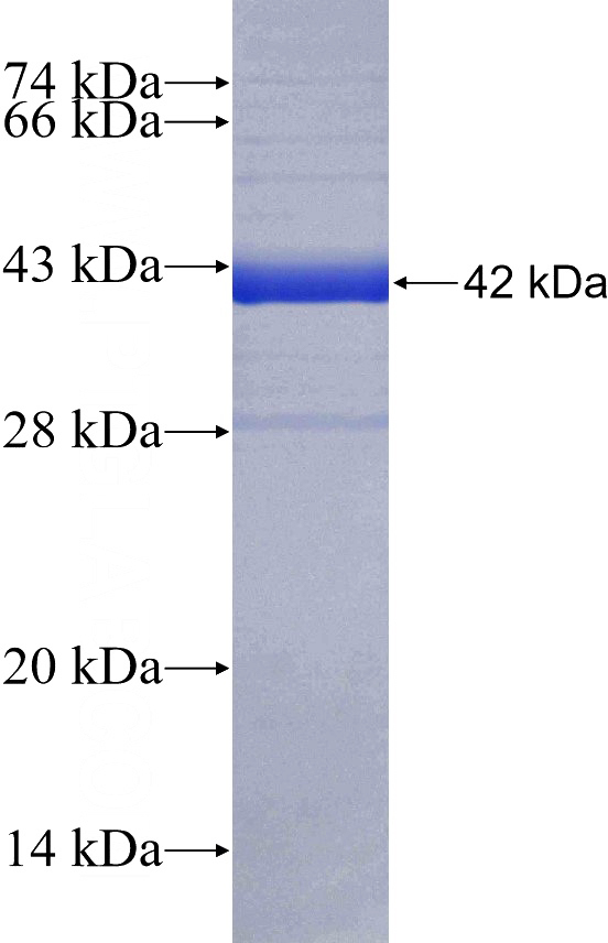 Recombinant Human CLC SDS-PAGE