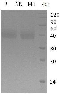 Mouse Cd276/B7h3 (His tag) recombinant protein