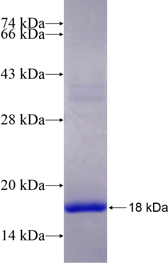Recombinant Human NGB SDS-PAGE