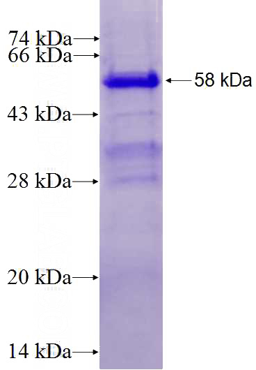 Recombinant Human STAG1 SDS-PAGE