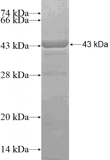 Recombinant Human DGKK SDS-PAGE
