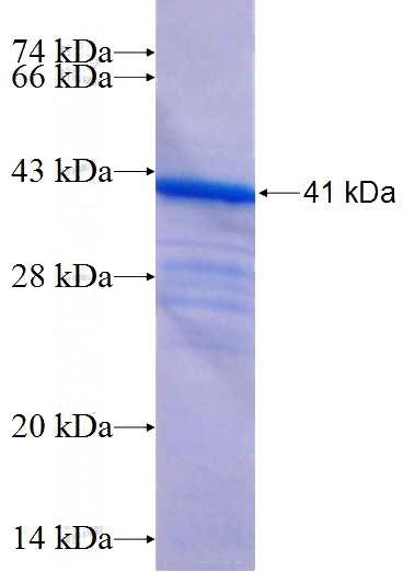 Recombinant Human XAB2 SDS-PAGE