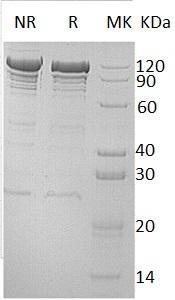 Human VCL recombinant protein