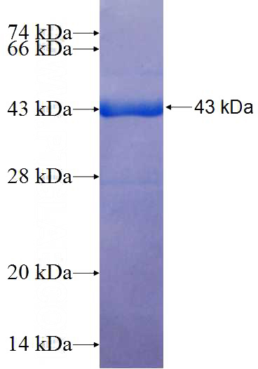 Recombinant Human SILV SDS-PAGE