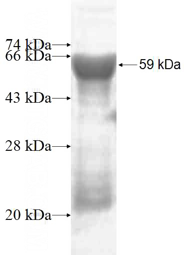 Recombinant Human FLAD1 SDS-PAGE
