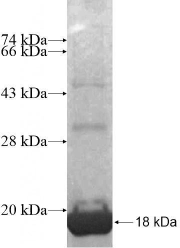 Recombinant Human SLC25A40 SDS-PAGE