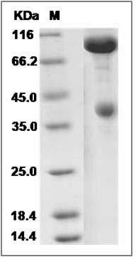 Rat c-MET / HGFR Protein (Fc Tag) SDS-PAGE