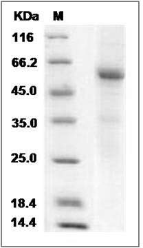 Human RANKL / OPGL / TNFSF11 / CD254 Protein (Fc Tag) SDS-PAGE