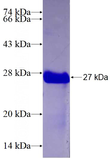 Recombinant Human MTBP SDS-PAGE