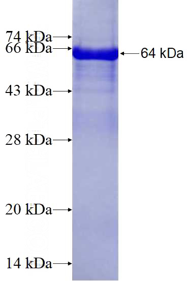 Recombinant Human SLC12A2 SDS-PAGE