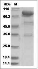 UNC5B protein SDS-PAGE