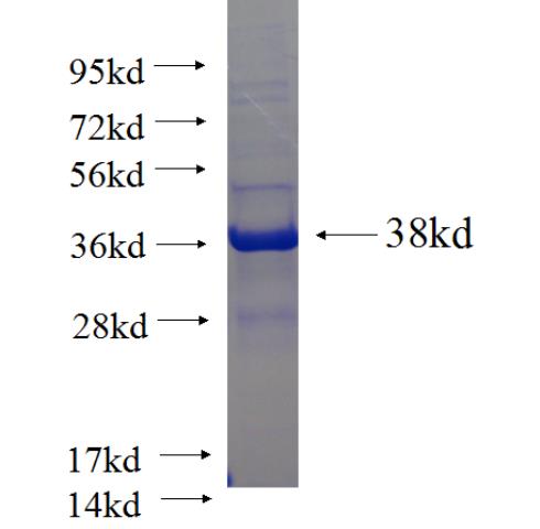 Recombinant human HLA-G SDS-PAGE