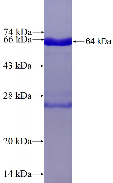 Recombinant Human RWDD2B SDS-PAGE