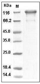 Human PDGFRa / CD140a Protein (Fc Tag) SDS-PAGE