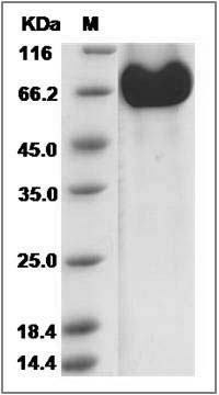 Human EphA2 Protein (His Tag) SDS-PAGE