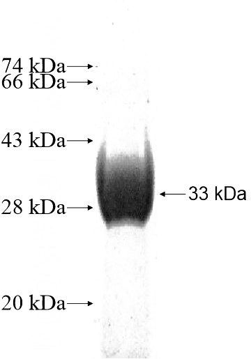 Recombinant Human THAP3 SDS-PAGE
