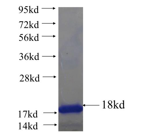 Recombinant human DGKB SDS-PAGE