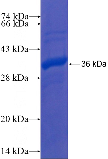 Recombinant Human KLHL3 SDS-PAGE