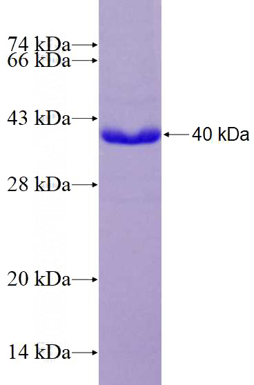 Recombinant Human AVIL SDS-PAGE