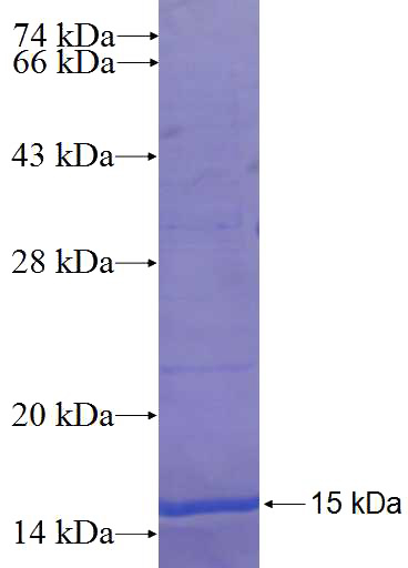 Recombinant Human ZNF322A SDS-PAGE