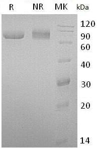 Human LTF/GIG12/LF (His tag) recombinant protein