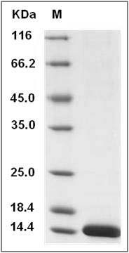 Cynomolgus B2M / Beta-2-microglobulin Protein (His Tag) SDS-PAGE