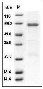 Human TRIB3 / TRB3 Protein (GST Tag) SDS-PAGE