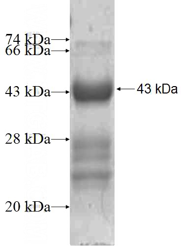 Recombinant Human KCNMB4 SDS-PAGE