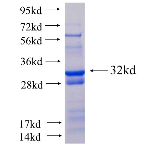 Recombinant human NDUFA9 SDS-PAGE