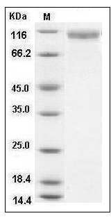 Mouse HER2 / ErbB2 / CD340 Protein (His Tag) SDS-PAGE