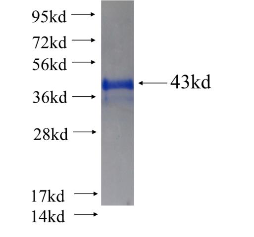 Recombinant human RBM3(Full length) SDS-PAGE