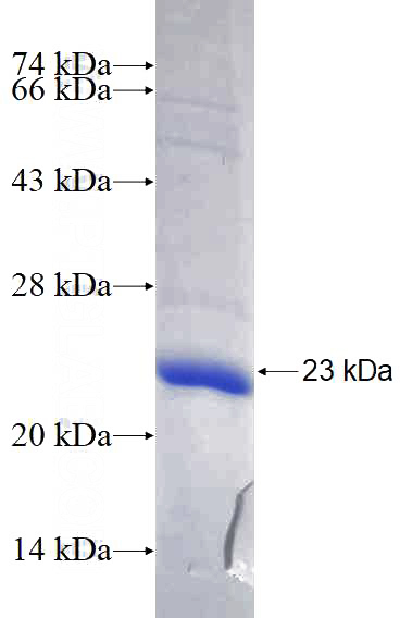 Recombinant Human LGR5 SDS-PAGE
