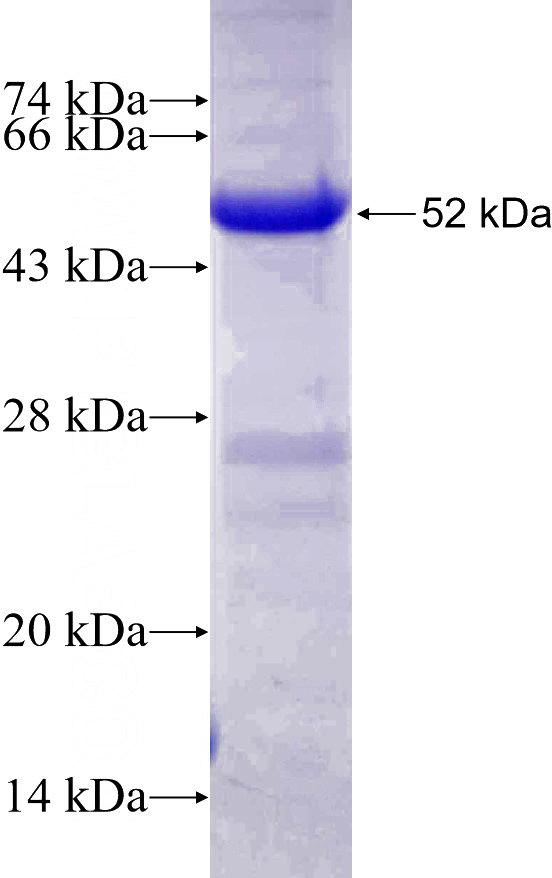 Recombinant Human INPP5E SDS-PAGE