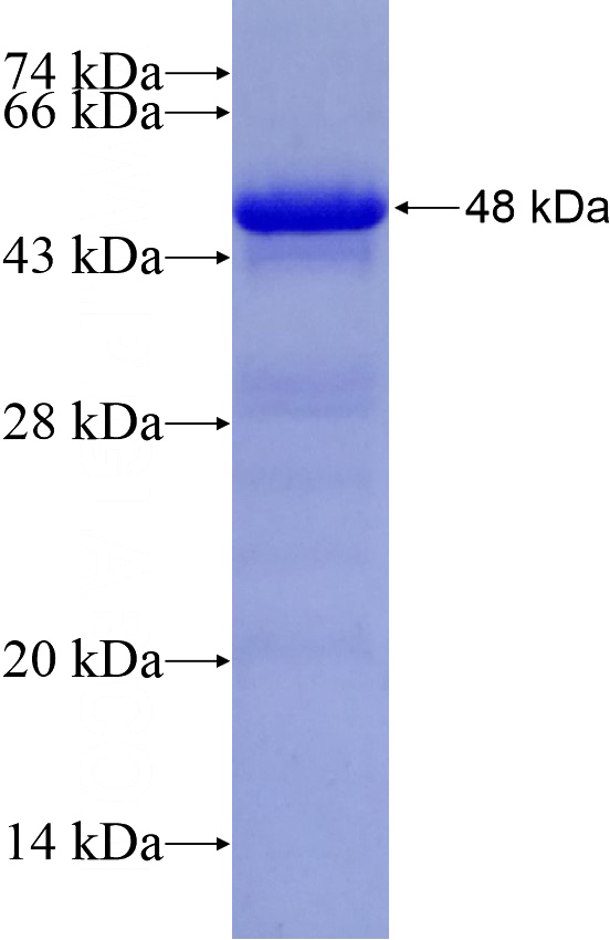 Recombinant Human PNMA2 SDS-PAGE